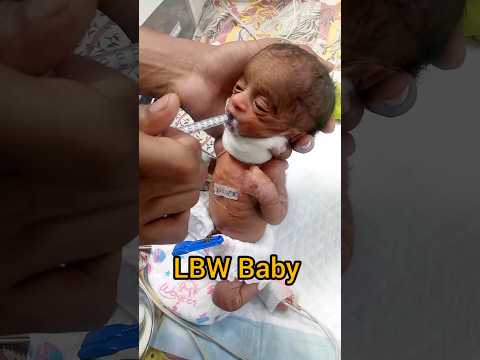 So cute 🥰 baby NICU #youtubeshorts #short #nicu #cutebabycarebaby