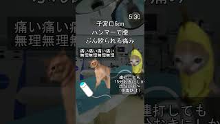 無痛分娩レポ② #shorts  #猫ミーム