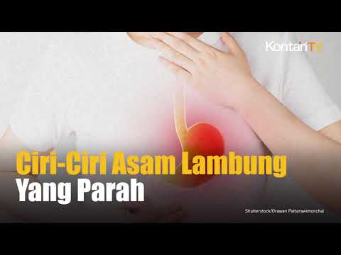 Jangan Diremehkan, Ciri Ciri Asam Lambung yang Parah