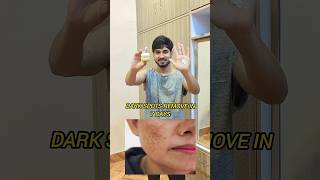 Download lagu Garnier Vitamin C Cream 💛 Dark Spots Gone in 7 Days? #shorts mp3 Download lagu Garnier Vitamin C Cream 💛 Dark Spots Gone in 7 Days? #shorts mp3