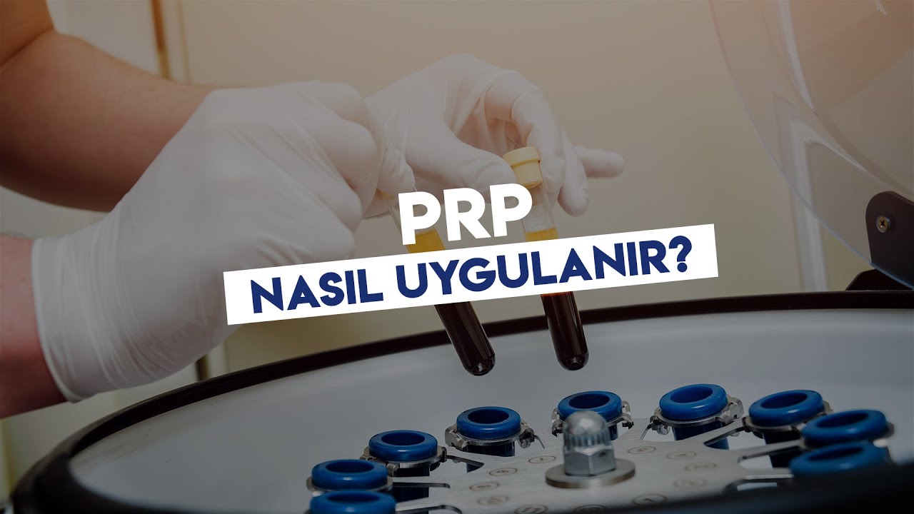 PRP nasıl uygulanır?