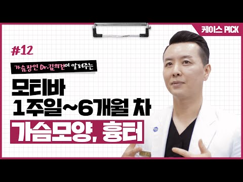 [가슴성형] 가슴확대수술 후 6개월 가슴모양, 흉터 케이스 리뷰 | 윈느성형외과 라벨윈느 유튜브 영상