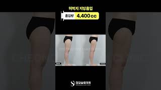 다리 사이에 틈, 드디어 생겼다.