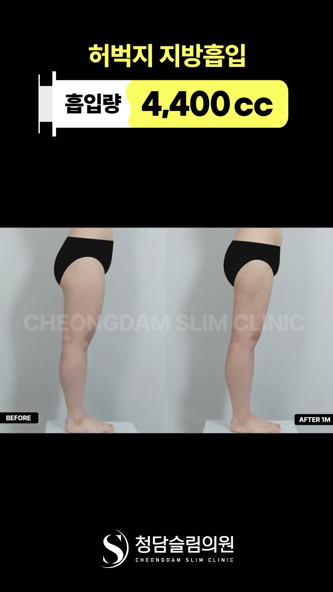 다리 사이에 틈, 드디어 생겼다.