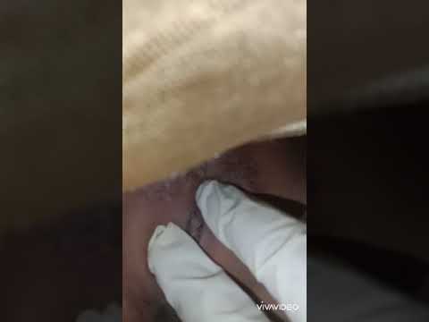 Sunat Perempuan Syar'i (Video Edukasi)