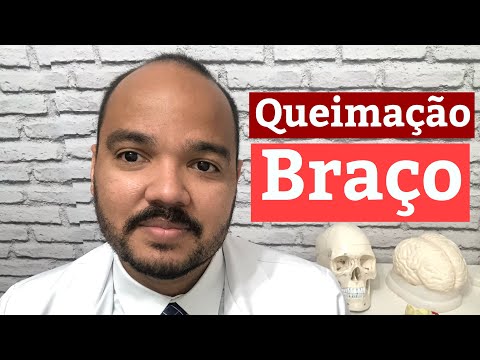 BURNING ARM AND HAND - Most common causes