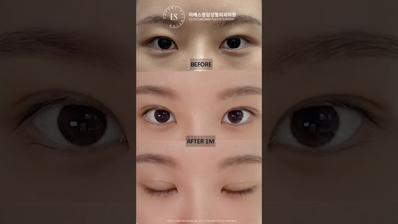 이에스 유튜브