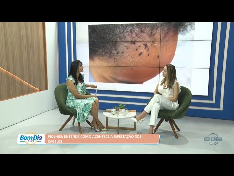 Piolhos: Entenda como acontece a infestação nos cabelos 10 10 2022