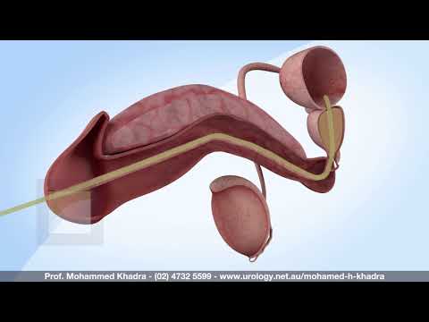 Prostatitis férfi hatalma