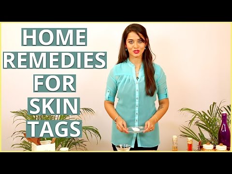 3 Best Natural Home Remedies To REMOVE SKIN TAGS At Home – DIY