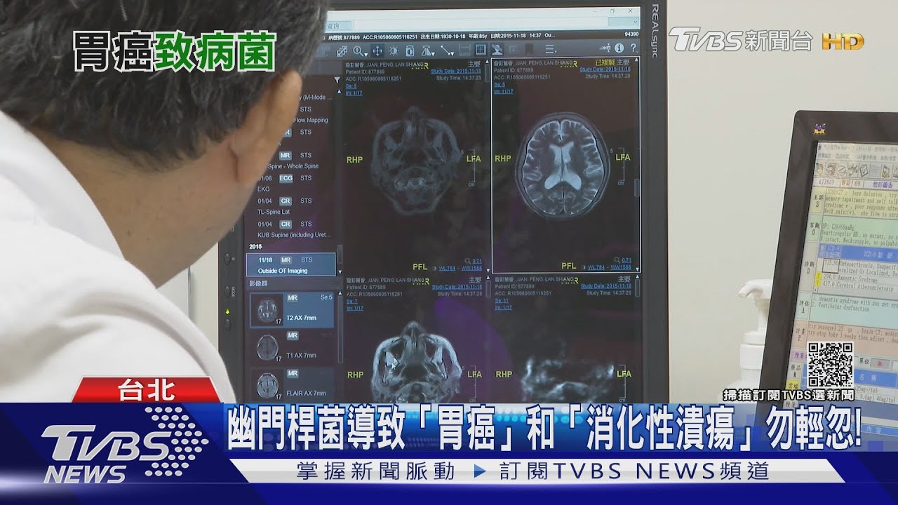 輕忽衛生習慣!幽門桿菌找上門 恐罹「這種癌」當心致命!