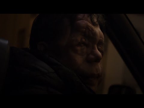 Under the Skin - Adam Pearson scene