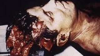 JFK file release head wound  confusion now cleared up, conspiracy over.