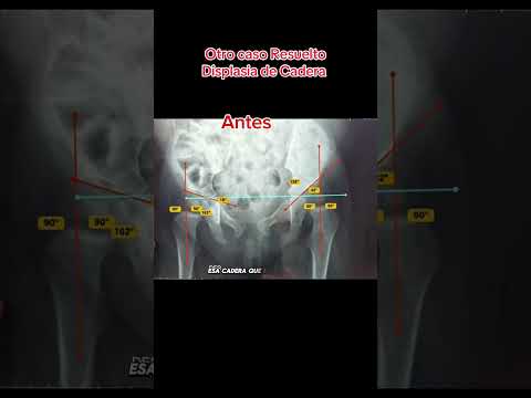 Ruben Sosa Arauco-14