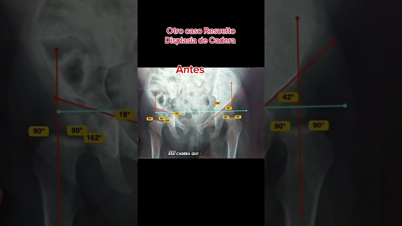 Ruben Sosa Arauco-14
