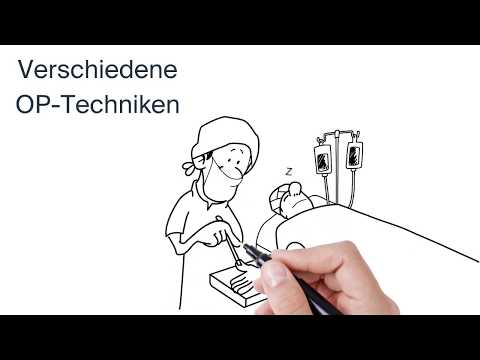 Behandlung einer Rhizarthrose (by ATOS Kliniken)