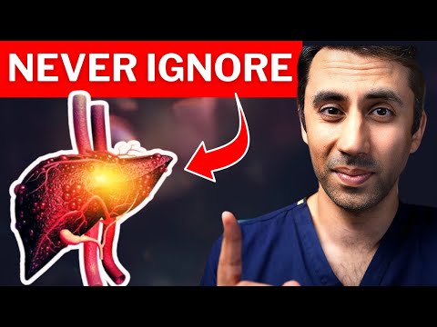 Early Warning Signs of Fatty Liver Disease (You Might Be Ignoring) 🚩