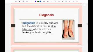 باطنية المستنصرية مرحلة خامسة  Pediatrics Rheumatic fever & HSP part 2