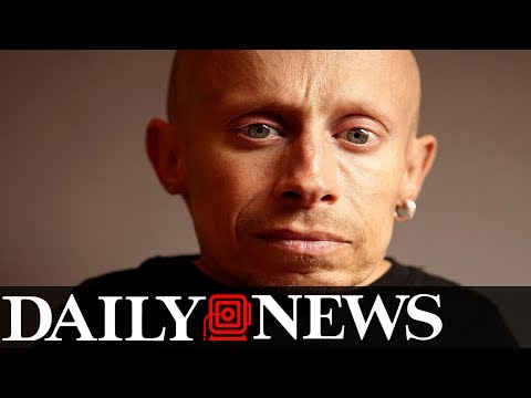 Verne Troyer, Mini Me in ‘Austin Powers,’ dead at 49