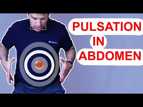 Pulsation in the Stomach (Abdomen) - Aortic Aneurysm USMLE 1