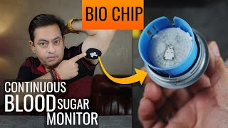 Monitor Blood Sugar Without Needles: Game-Changer Tech! -  UltraHuman M1