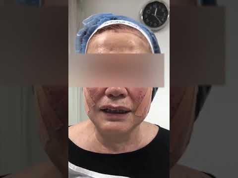 video YEevosJMpsM