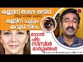 കണ്ണിന് താഴെ തടിപ്പ് നീര് കണ്ണിന് ചു�
