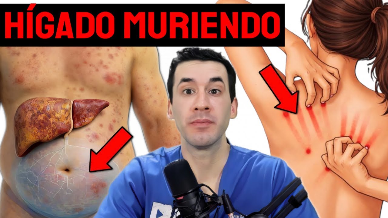 10 EARLY SIGNS OF LIVER DAMAGE