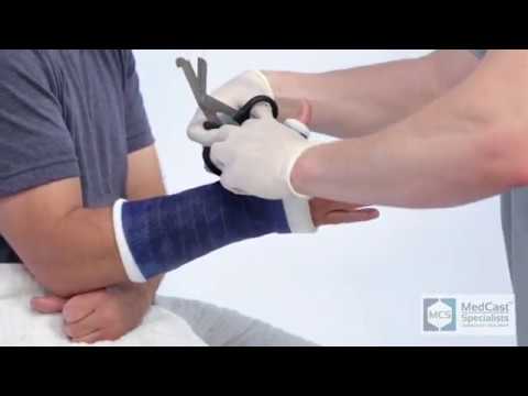 How to apply a Thumb Spica Cast  - Plus Cast Removal