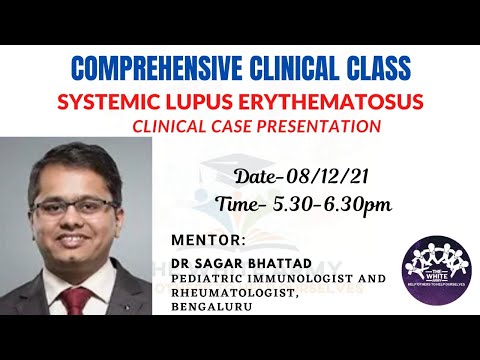 SYSTEMIC LUPUS ERYTHEMATOSUS Clinicl Case Presentation