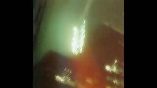 BLOXX - Second Opinion