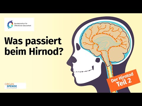 Der Hirntod - Teil 2: Was passiert beim Hirntod?