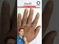 Do fingernails die?