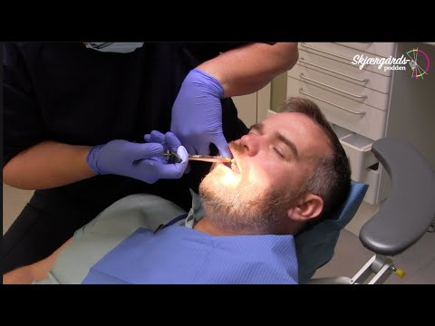Tannlegeskrekk ep 3 - Bedøvelse og fjerning av rot
