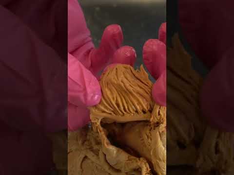 Amazing Muscle Inside a REAL Human Heart