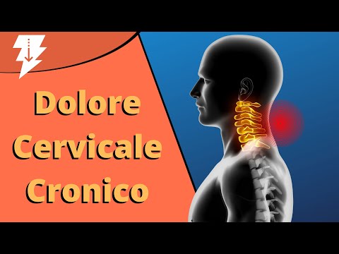Dolore cervicale cronico | Come risolvere DEFINITIVAMENTE