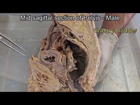 Mid sagittal section of Pelvis - Male and Female in Gujarat