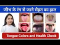 जीभ Tongue के रंग से जाने सेहत का हाल Tongue Colors Si