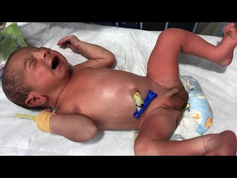 Cute Baby Diaper Changing & Gentle Care in NICU 💞 | Heart-Touching Moments #NICUBaby #BabyCare