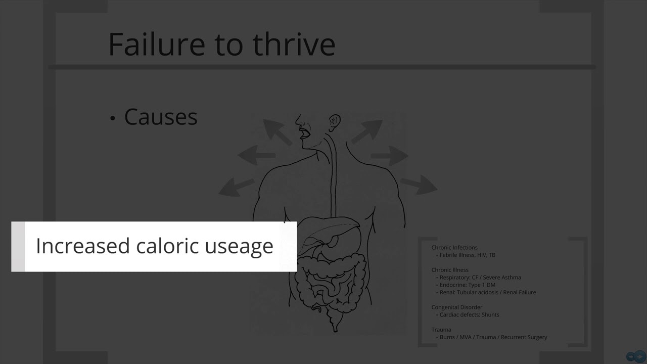 Paediatrics - failure to thrive - YouTube