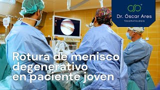 Rotura de menisco degenerativo en paciente joven - Dr. Oscar Ares