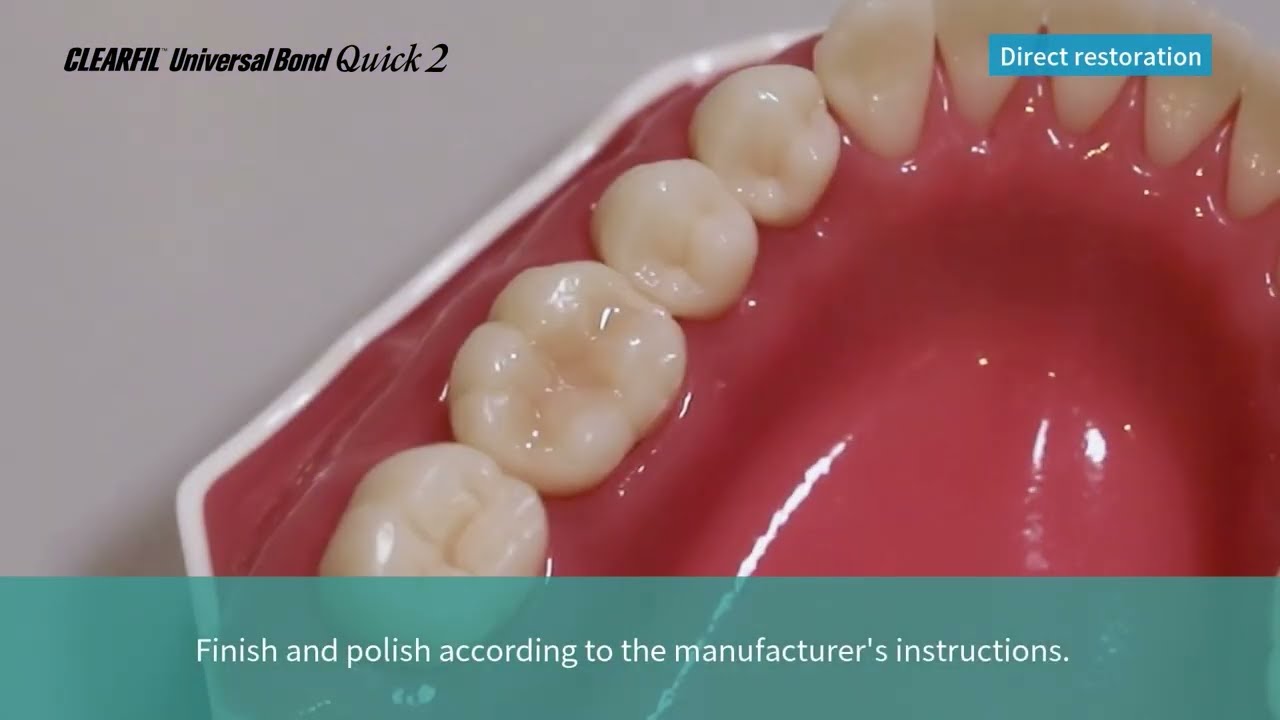 3. Direct Restoration with CLEARFIL MAJESTY ES Flow