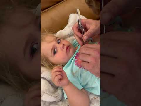 Dad has to use tweezers to remove a pony bead from his daughter's nose!