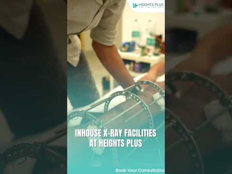 Heights Plus Patient Success Story YouTube Short Cover