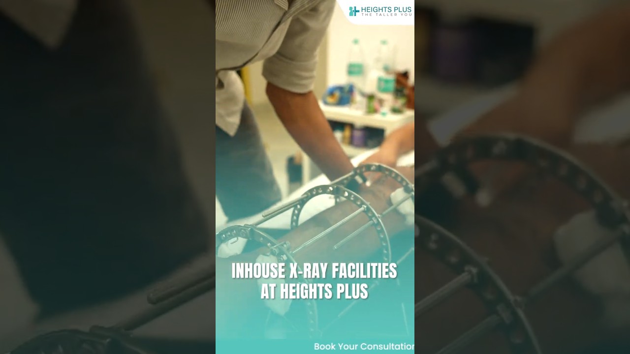 In-house X-Ray Facility for Better Monitoring & Faster Recovery | Heights Plus