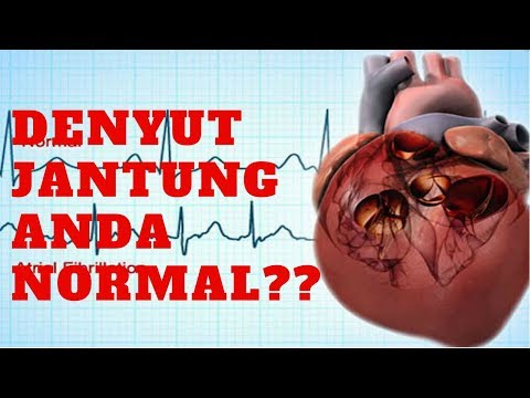 Apa patogen perempuan yang baik memiliki Obat apa untuk meningkatkan potensi di diabetes