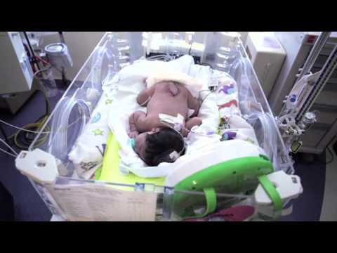 Newborn Baby with Spina Bifida Undergoes Multiple Surgeries