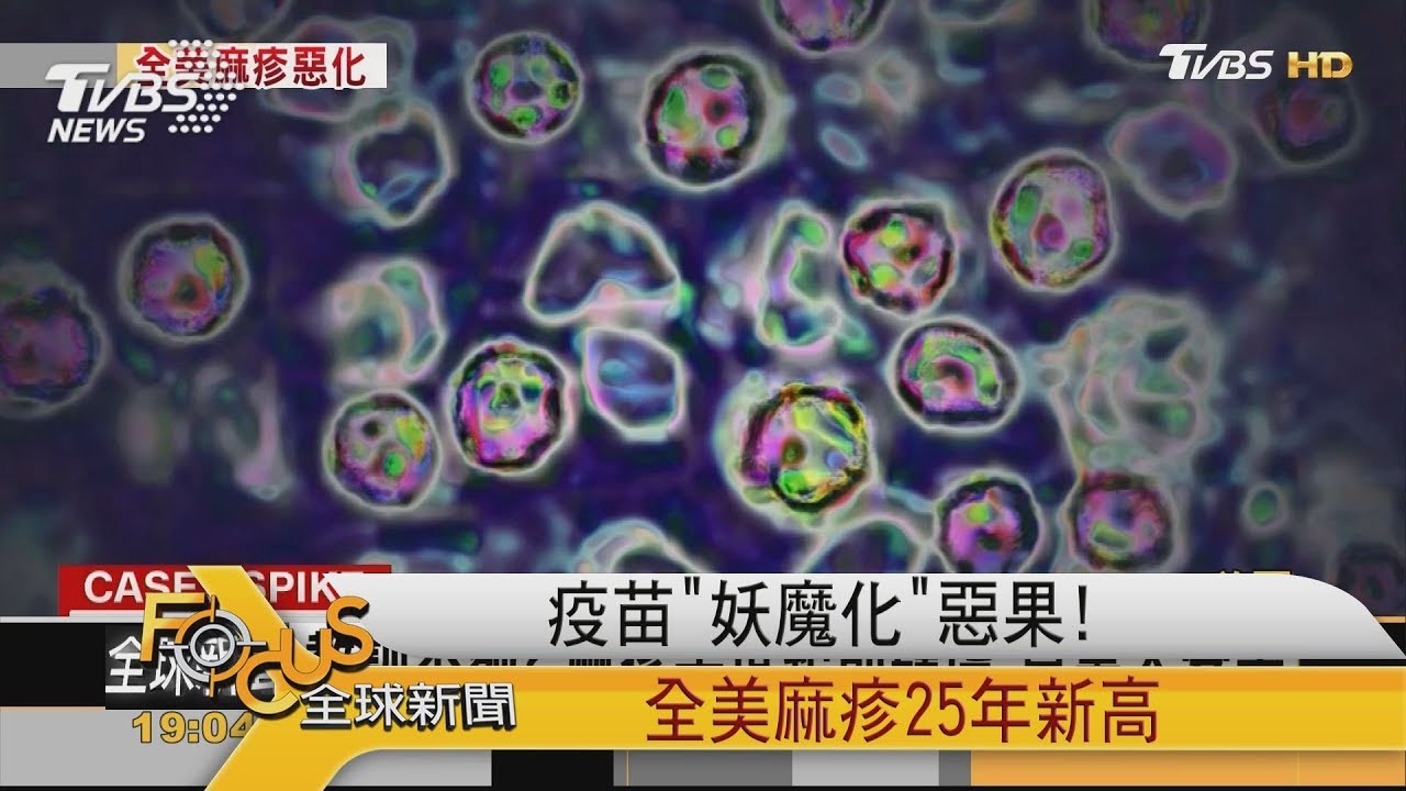 疫苗「妖魔化」惡果!全美麻疹25年新高
