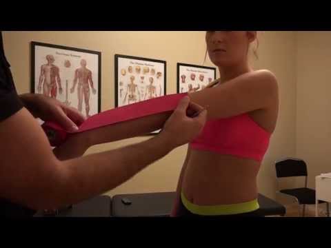 Kinesiotejp lateral epikondylalgi (tennisarm, musarm)