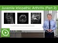 Juvenile Idiopathic Arthritis (JIA): Diagnosis & Management – Pediatrics | Lecturio